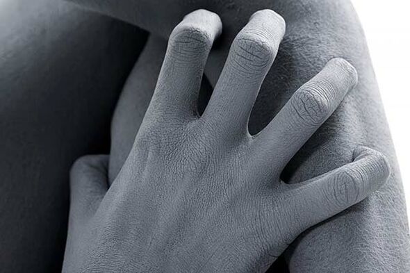 Démangeaisons cutanées comme effet secondaire de la prise de stimulants de puissance